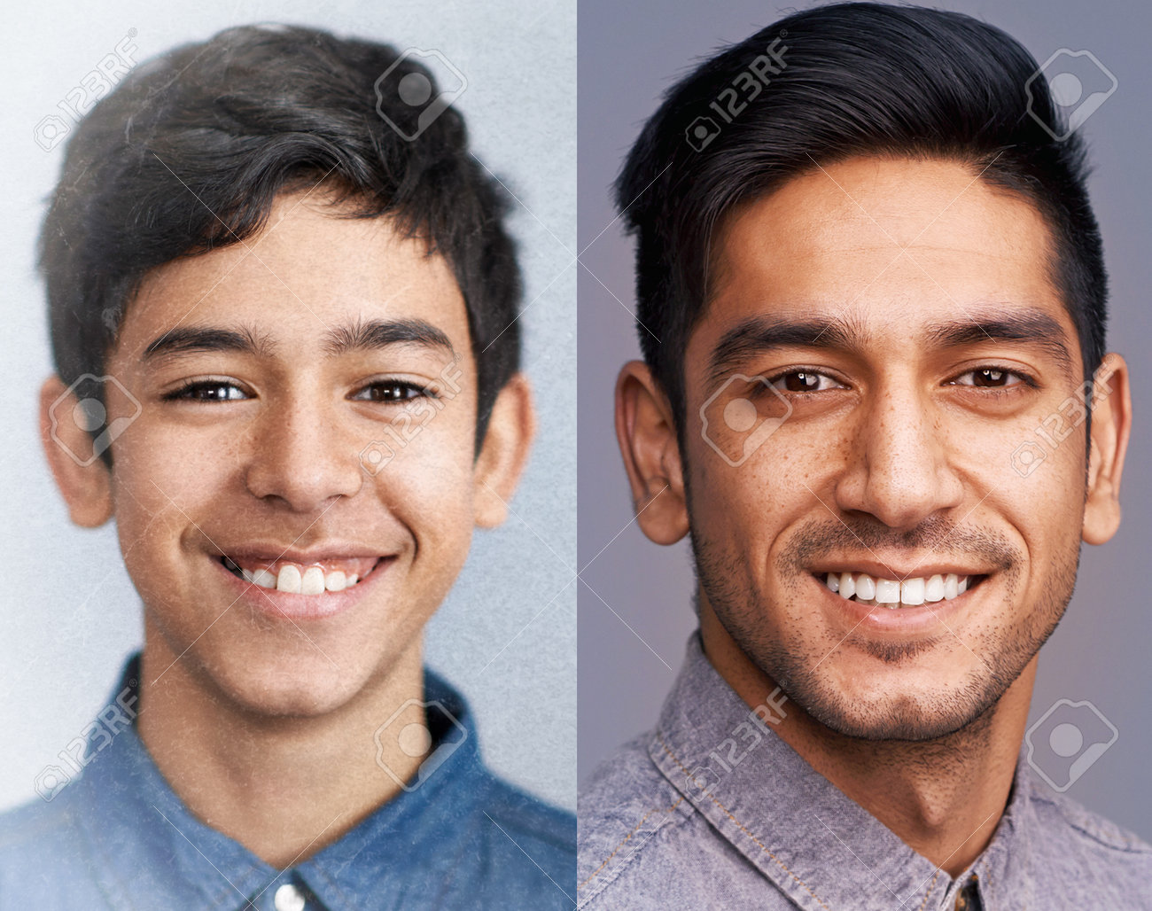 Two photos of the same man several years apart showing the teeth improvements by his braces treatment