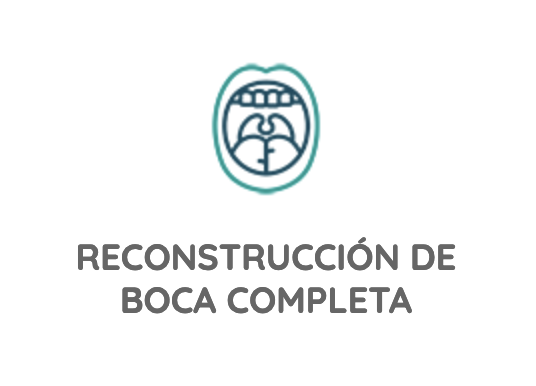 Reconstrucción de boca completa